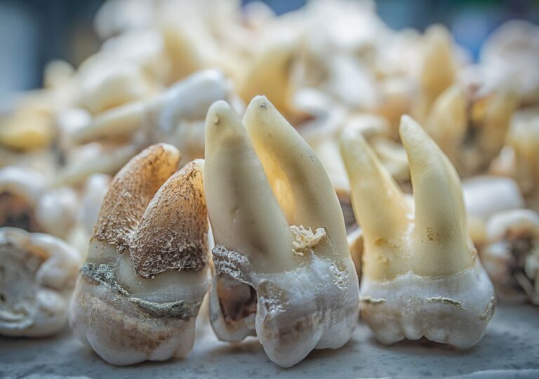 Biofilm teeth dental