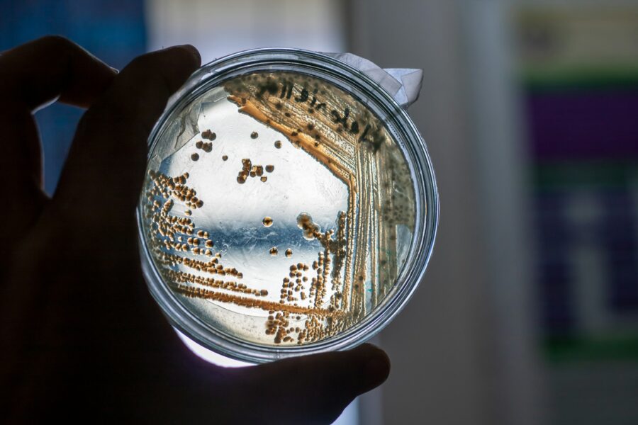 Petri dish bacteria