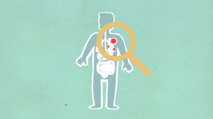 How herd immunity really works and why it cannot do the job alone