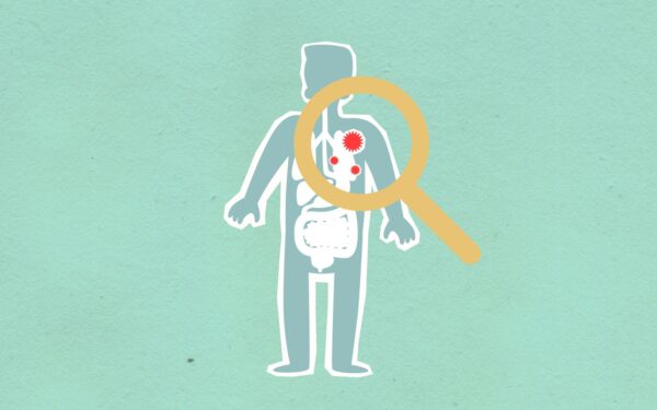 How herd immunity really works and why it cannot do the job alone