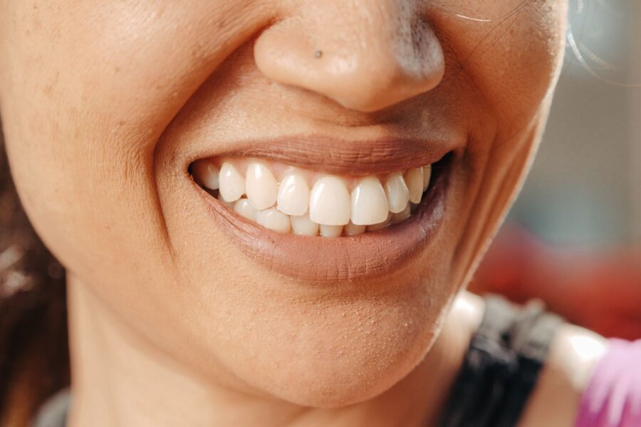 Close healthy teeth